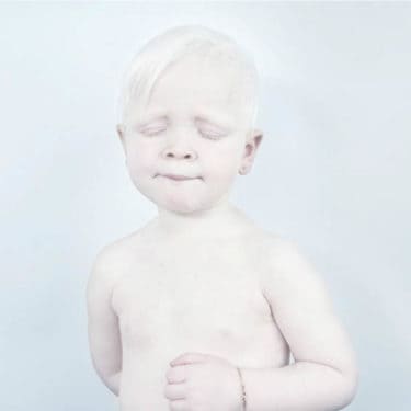 albinism-sanne-de-wilde-alba-ca-zapada-3