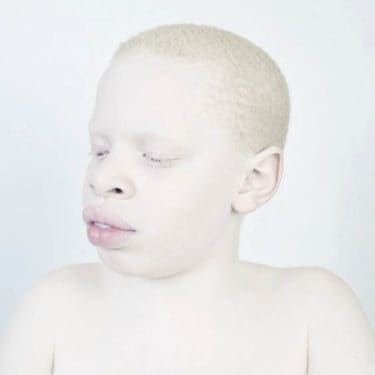 albinism-sanne-de-wilde-alba-ca-zapada-4